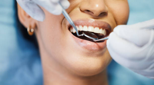 Best Emergency Dentist for Knocked-Out Tooth in Bristol, CT