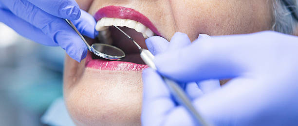 Best Mobile Emergency Dentist in Bristol, CT